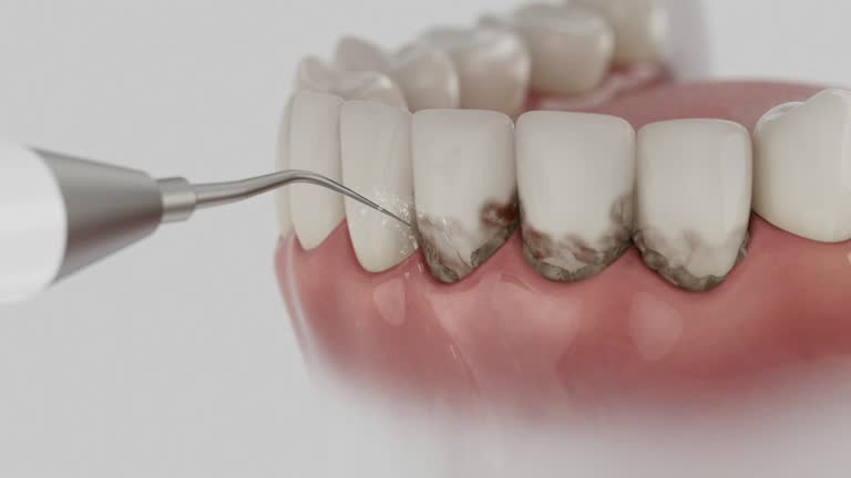 Reliable Dental contractor in Centerville, MN by Dentist Open Now